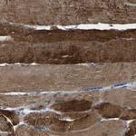 SLC25A25 Antibody in Immunohistochemistry (Paraffin) (IHC (P))