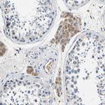 SLC25A25 Antibody in Immunohistochemistry (Paraffin) (IHC (P))