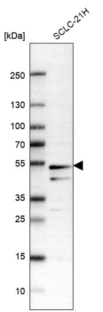 SLC25A25 Antibody in Western Blot (WB)