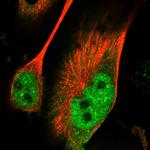 PAK7 Polyclonal Antibody