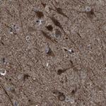 NCKAP1 Antibody in Immunohistochemistry (Paraffin) (IHC (P))
