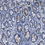 ADH4 Polyclonal Antibody