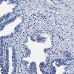 ADH4 Antibody in Immunohistochemistry (Paraffin) (IHC (P))