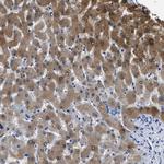 ADH4 Antibody in Immunohistochemistry (Paraffin) (IHC (P))