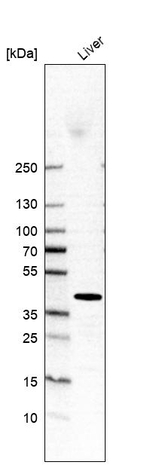 ADH4 Antibody in Western Blot (WB)