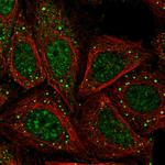 ASAP3 Polyclonal Antibody