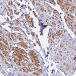 ASAP3 Antibody in Immunohistochemistry (Paraffin) (IHC (P))