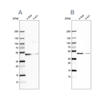 EPHX1 Antibody in Western Blot (WB)