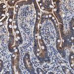 ACADVL Antibody in Immunohistochemistry (Paraffin) (IHC (P))