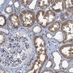 ACADVL Antibody in Immunohistochemistry (Paraffin) (IHC (P))