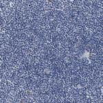 ACADVL Antibody in Immunohistochemistry (Paraffin) (IHC (P))