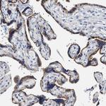 ACADVL Antibody in Immunohistochemistry (Paraffin) (IHC (P))