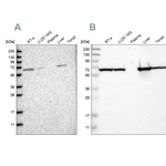ACADVL Antibody in Western Blot (WB)