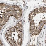 GFR alpha-3 Antibody in Immunohistochemistry (Paraffin) (IHC (P))