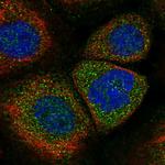 SOCS5 Polyclonal Antibody