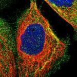 AMACR Polyclonal Antibody