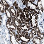 AMACR Antibody in Immunohistochemistry (Paraffin) (IHC (P))