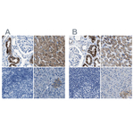 AMACR Antibody in Immunohistochemistry (Paraffin) (IHC (P))
