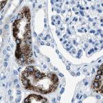 AMACR Antibody in Immunohistochemistry (Paraffin) (IHC (P))