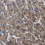 AMACR Antibody in Immunohistochemistry (Paraffin) (IHC (P))