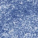 AMACR Antibody in Immunohistochemistry (Paraffin) (IHC (P))