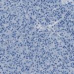 AMACR Antibody in Immunohistochemistry (Paraffin) (IHC (P))