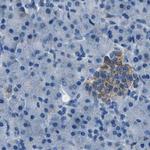 AMACR Antibody in Immunohistochemistry (Paraffin) (IHC (P))