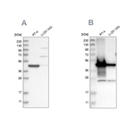 AMACR Antibody in Western Blot (WB)