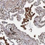PLA2G3 Antibody in Immunohistochemistry (Paraffin) (IHC (P))