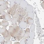 PLA2G3 Antibody in Immunohistochemistry (Paraffin) (IHC (P))