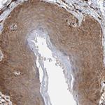 PLA2G3 Antibody in Immunohistochemistry (Paraffin) (IHC (P))