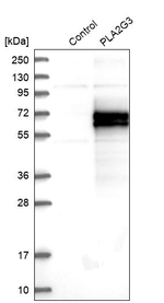 PLA2G3 Antibody in Western Blot (WB)