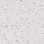 Fibrillin 1 Antibody in Immunohistochemistry (Paraffin) (IHC (P))