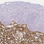 Fibrillin 1 Antibody in Immunohistochemistry (Paraffin) (IHC (P))