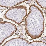 Fibrillin 1 Antibody in Immunohistochemistry (Paraffin) (IHC (P))