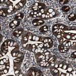 PASK Antibody in Immunohistochemistry (Paraffin) (IHC (P))