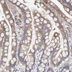 SGPL1 Antibody in Immunohistochemistry (Paraffin) (IHC (P))