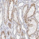 SGPL1 Antibody in Immunohistochemistry (Paraffin) (IHC (P))