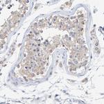 SGPL1 Antibody in Immunohistochemistry (Paraffin) (IHC (P))