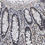 USP16 Antibody in Immunohistochemistry (Paraffin) (IHC (P))