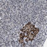 USP16 Antibody in Immunohistochemistry (Paraffin) (IHC (P))