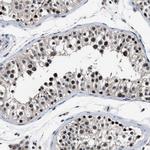 USP16 Antibody in Immunohistochemistry (Paraffin) (IHC (P))