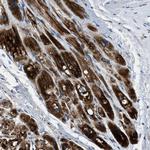 SLC25A11 Polyclonal Antibody