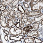 SLC25A11 Antibody in Immunohistochemistry (Paraffin) (IHC (P))