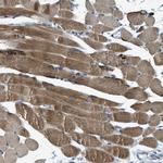 SLC25A11 Antibody in Immunohistochemistry (Paraffin) (IHC (P))