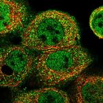 ACOX1 Polyclonal Antibody