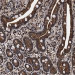 ACOX1 Antibody in Immunohistochemistry (Paraffin) (IHC (P))