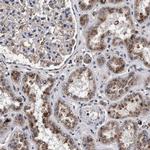 ACOX1 Antibody in Immunohistochemistry (Paraffin) (IHC (P))