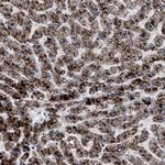 ACOX1 Antibody in Immunohistochemistry (Paraffin) (IHC (P))