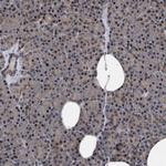 ACOX1 Antibody in Immunohistochemistry (Paraffin) (IHC (P))